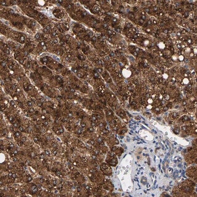 Anti-PPID antibody produced in rabbit