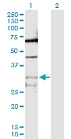 Anti-PPIE antibody produced in rabbit