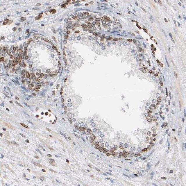Anti-PRKAG2 antibody produced in rabbit