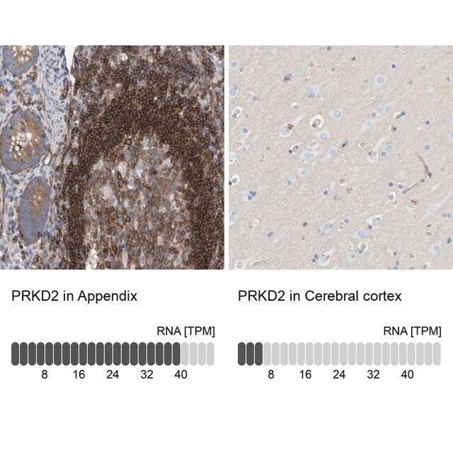 Anti-PRKD2 antibody produced in rabbit