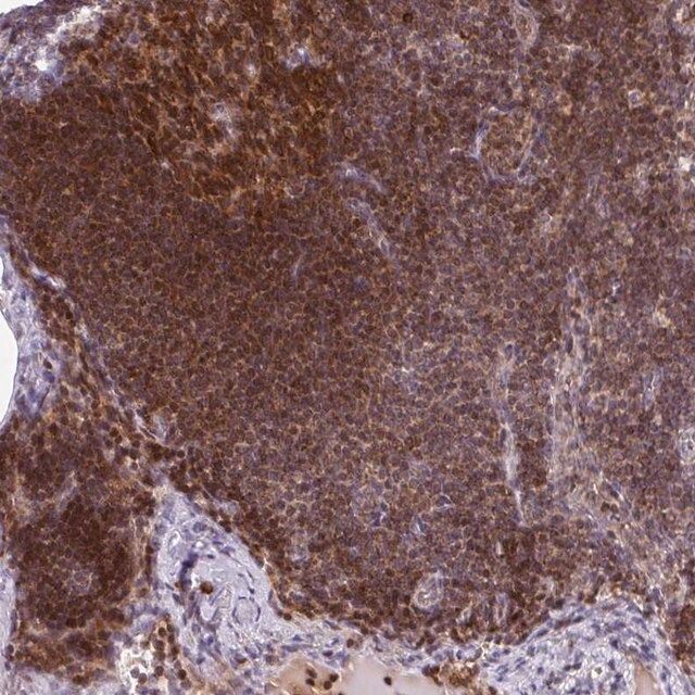 Anti-PRKCH antibody produced in rabbit