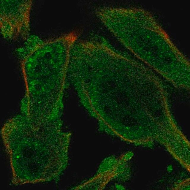 Anti-PRKAG1 antibody produced in rabbit