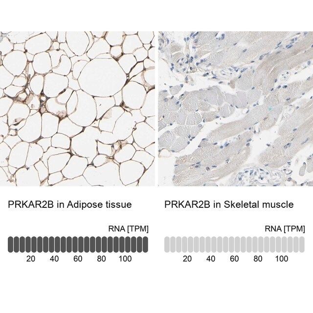 Anti-PRKAR2B antibody produced in rabbit