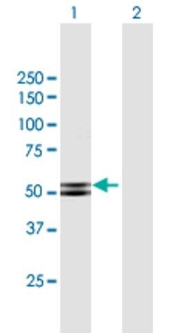 Anti-PRKAR2B antibody produced in mouse