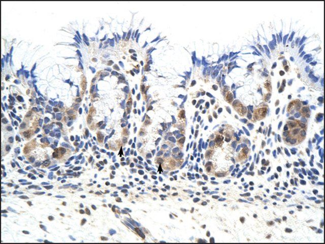 Anti-PRKRA antibody produced in rabbit
