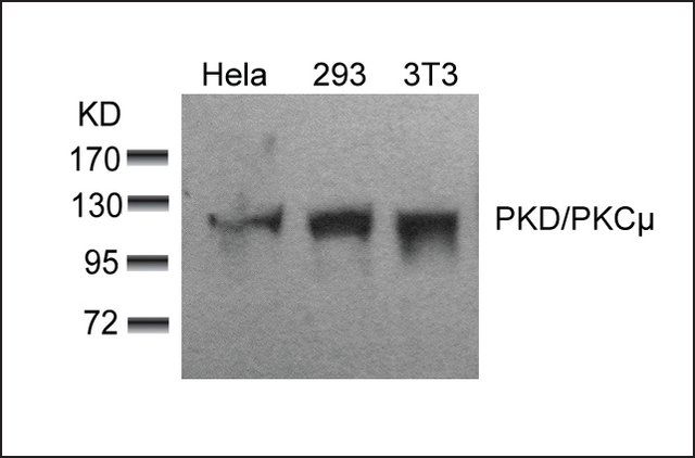 Anti-PRKD1 (Ab-910) antibody produced in rabbit