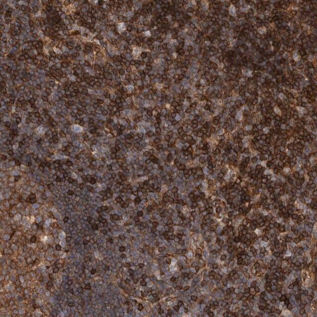 Anti-PRKCH antibody produced in rabbit