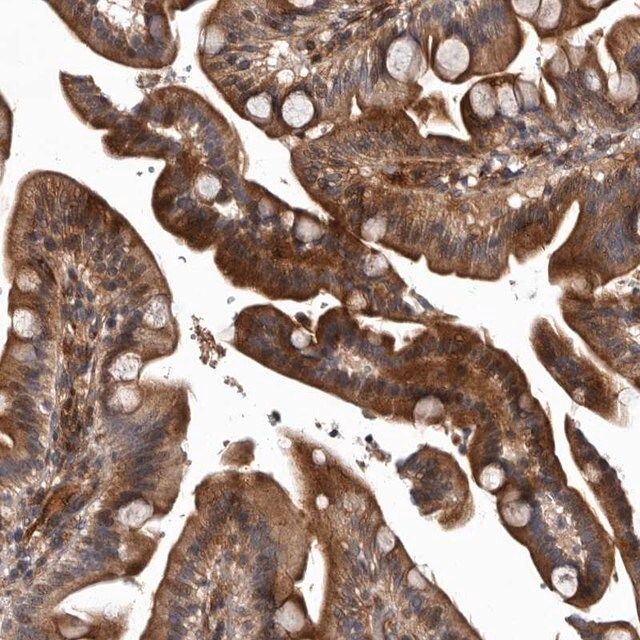 Anti-PRKD3 antibody produced in rabbit