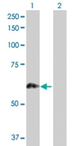 Anti-PRKCSH antibody produced in rabbit