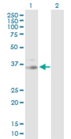 Anti-PRKG1 antibody produced in rabbit