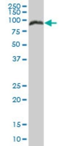 Anti-PRKCSH antibody produced in mouse