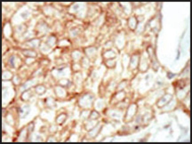 Anti-PRKWNK4 (C-term) antibody produced in rabbit