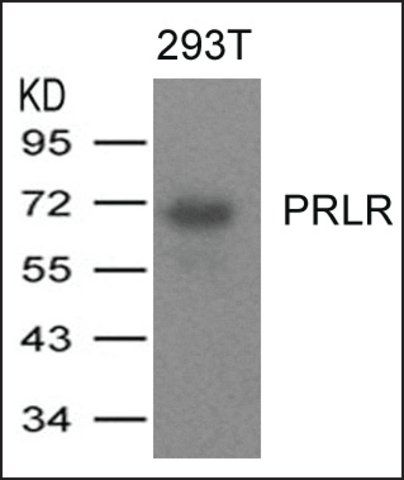 Anti-PRLR antibody produced in rabbit