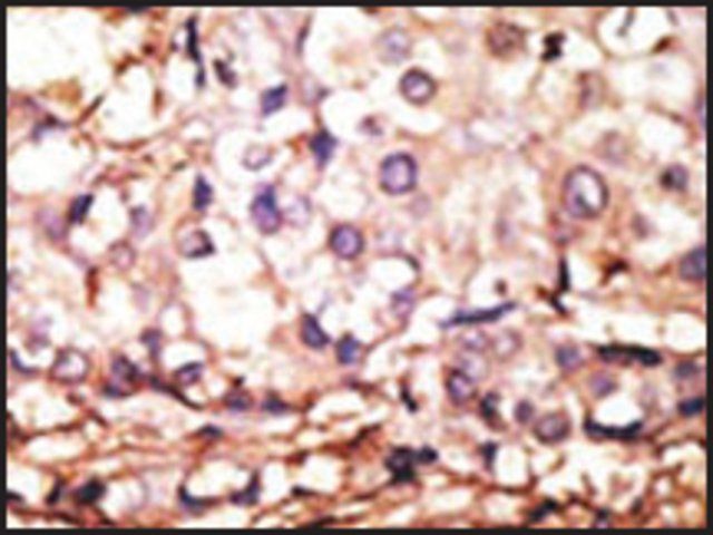 Anti-PRMT6 (N-term) antibody produced in rabbit