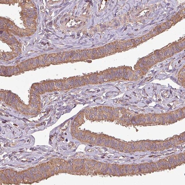 Anti-PLEKHM1 antibody produced in rabbit