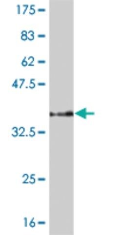 ANTI-PPARBP antibody produced in mouse
