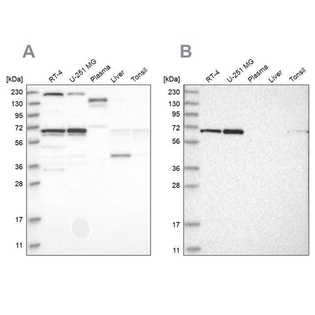 Anti-PPIL4 antibody produced in rabbit