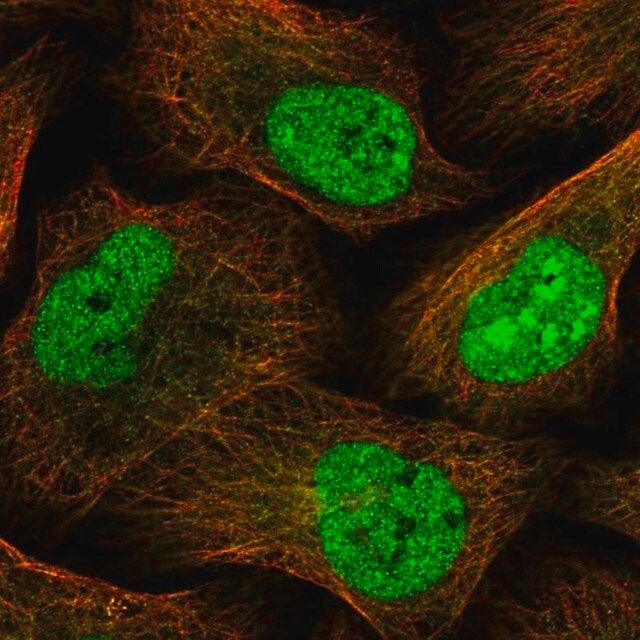 Anti-PPDPF antibody produced in rabbit