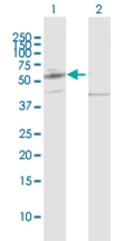 Anti-PPAT antibody produced in rabbit