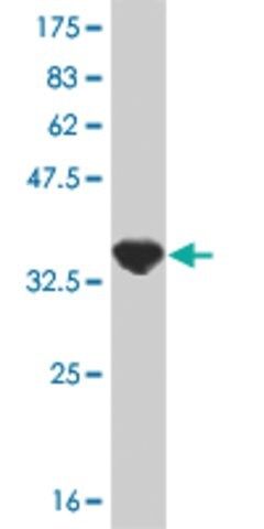 ANTI-PPARBP antibody produced in mouse