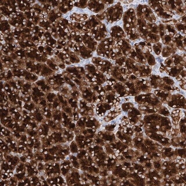 Anti-PPEF1 antibody produced in rabbit