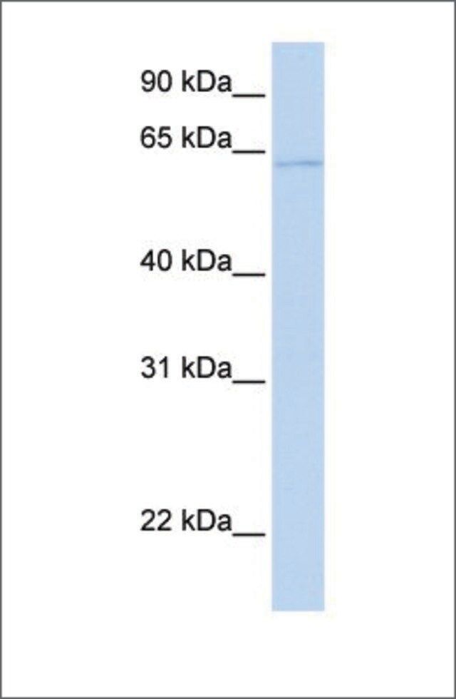 Anti-PPAT antibody produced in rabbit