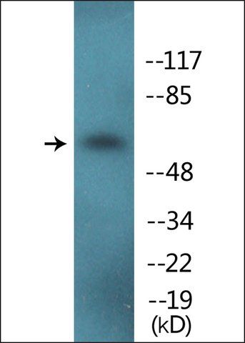 Anti-phospho-Tyrosine Hydroxylase (pSer<sup>8</sup>) antibody produced in rabbit