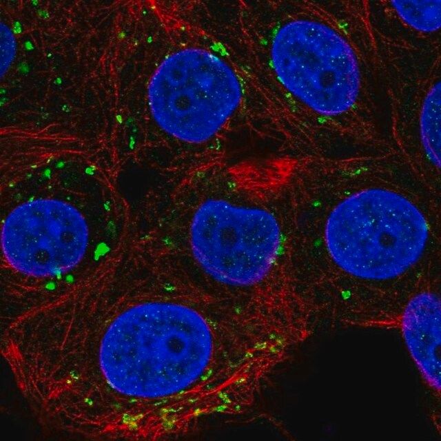 Anti-PIGQ antibody produced in rabbit