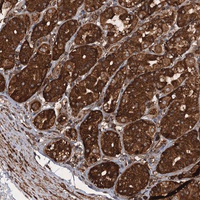 Anti-PIK3C2A antibody produced in rabbit