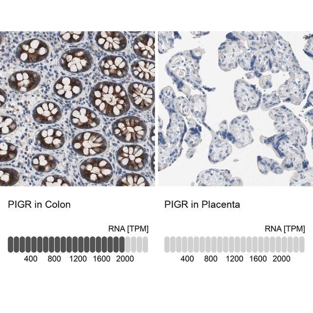 Anti-PIGR antibody produced in rabbit