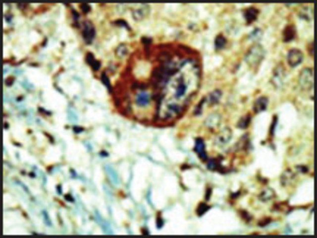 Anti-PI4KCA (C-term) antibody produced in rabbit