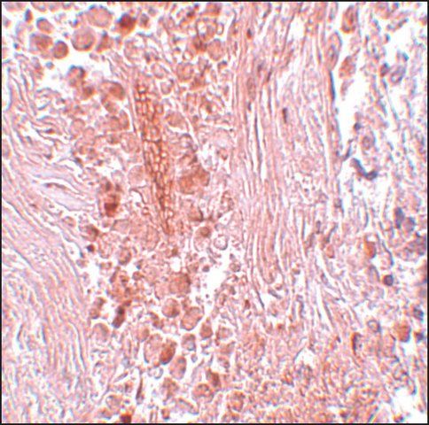 Anti-PIAS3 antibody produced in rabbit