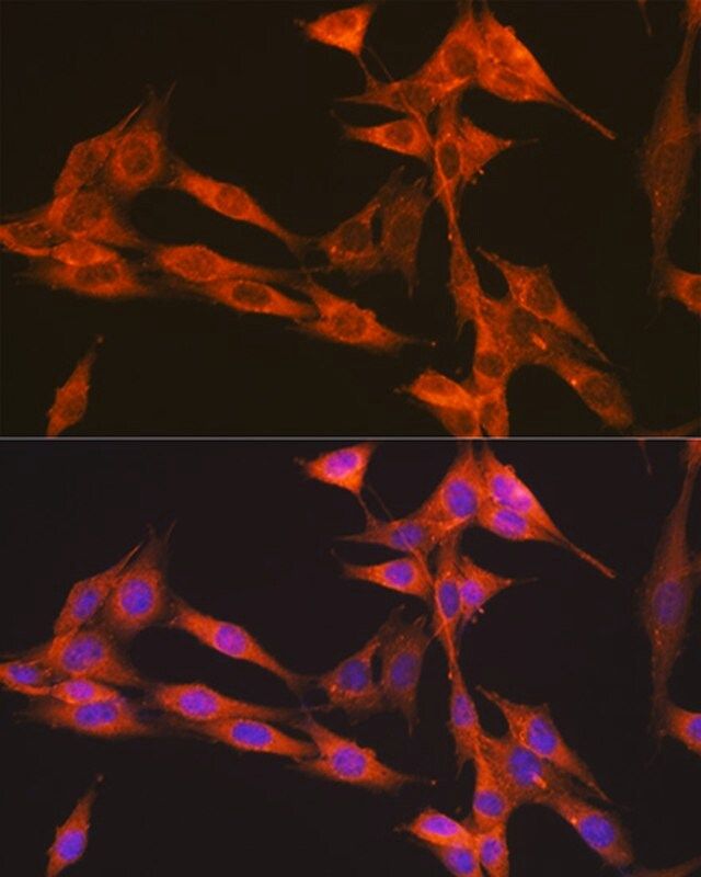 Anti-PIK3C3/VPS34 antibody produced in rabbit