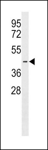 ANTI-PJVK (CENTER) antibody produced in rabbit