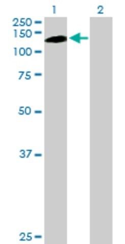Anti-PKN1 antibody produced in mouse