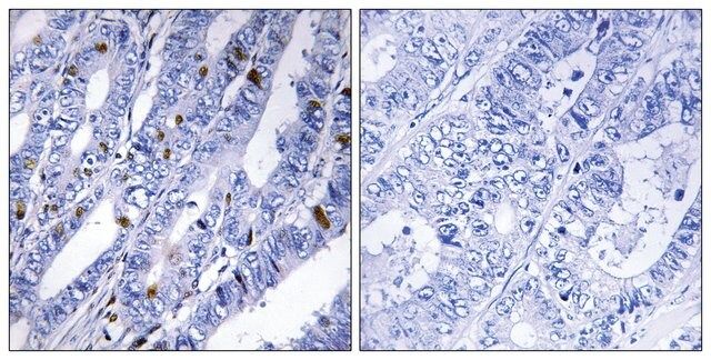 Anti-PKA-R2 β antibody produced in rabbit