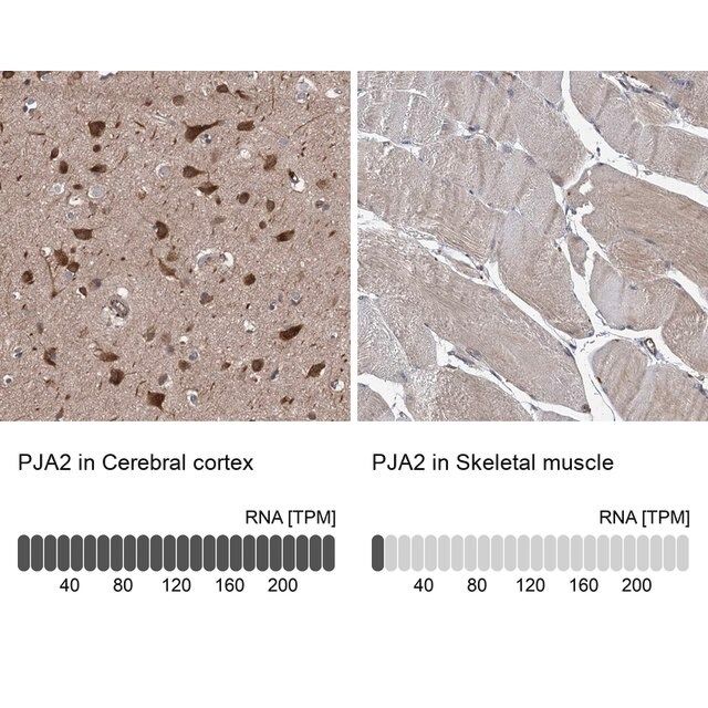 Anti-PJA2 antibody produced in rabbit