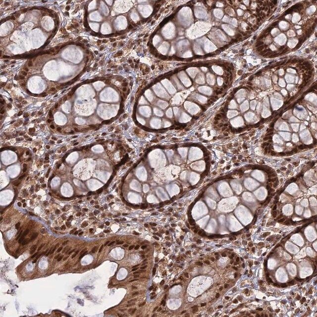Anti-PKIG antibody produced in rabbit