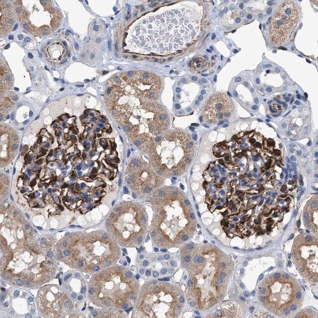 Anti-PKD1L1 antibody produced in rabbit