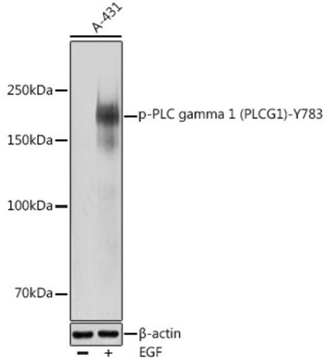 Anti-Phospho-PLC gamma 1 (PLCG1)-Y783 antibody produced in rabbit