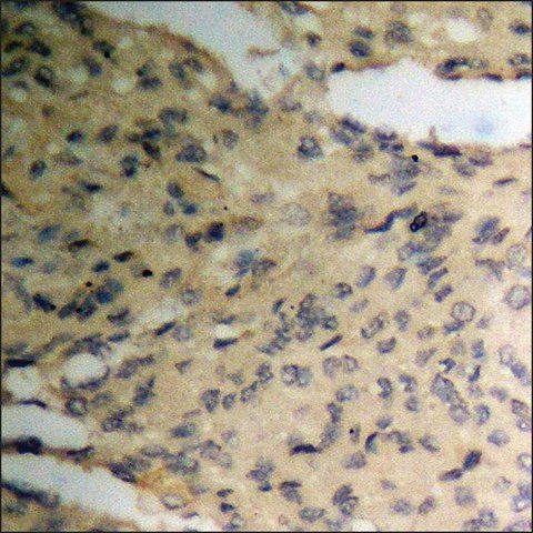 Anti-phospho-Pim-1 (pTyr<sup>309</sup>) antibody produced in rabbit