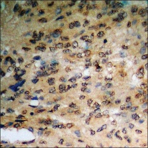 Anti-phospho-PKD1/2/3/PKC mu (pSer<sup>738</sup>+Ser<sup>742</sup>) antibody produced in rabbit