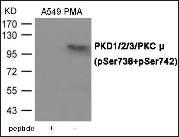Anti-phospho-PKD1/2/3/PKC μ (pSer<sup>738/742</sup>) antibody produced in rabbit