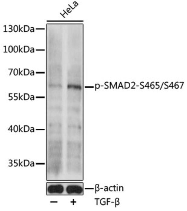 Anti-Phospho-SMAD2-S465/S467 antibody produced in rabbit