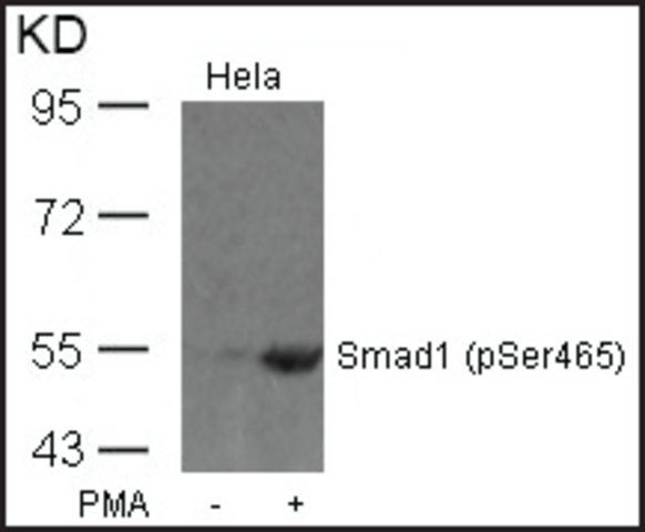 Anti-phospho-Smad1 (pSer<sup>465</sup>) antibody produced in rabbit