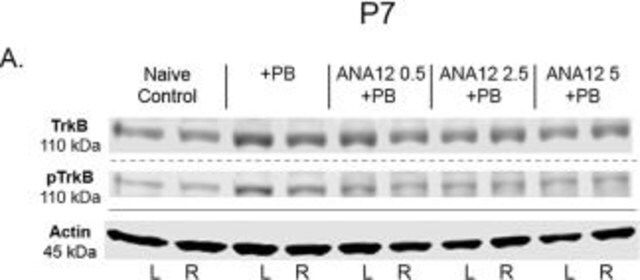 Anti-phospho-TrkB (Tyr816) Antibody