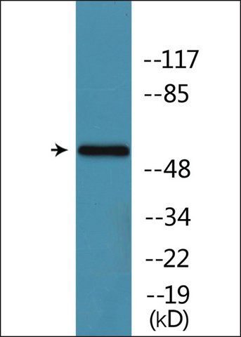 Anti-phospho-Tyrosine Hydroxylase (pSer<sup>31</sup>) antibody produced in rabbit