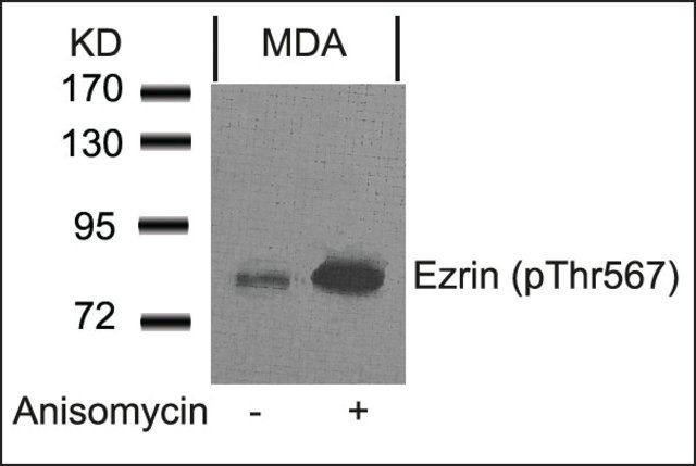 Anti-phospho-EZR (pThr<sup>567</sup>) antibody produced in rabbit