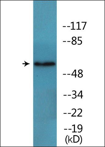 Anti-phospho-FRS2 (pTyr<sup>436</sup>) antibody produced in rabbit