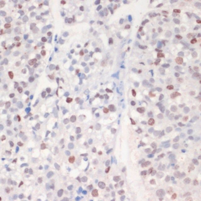 Anti-Phospho-γH2A.X-S139 antibody produced in rabbit